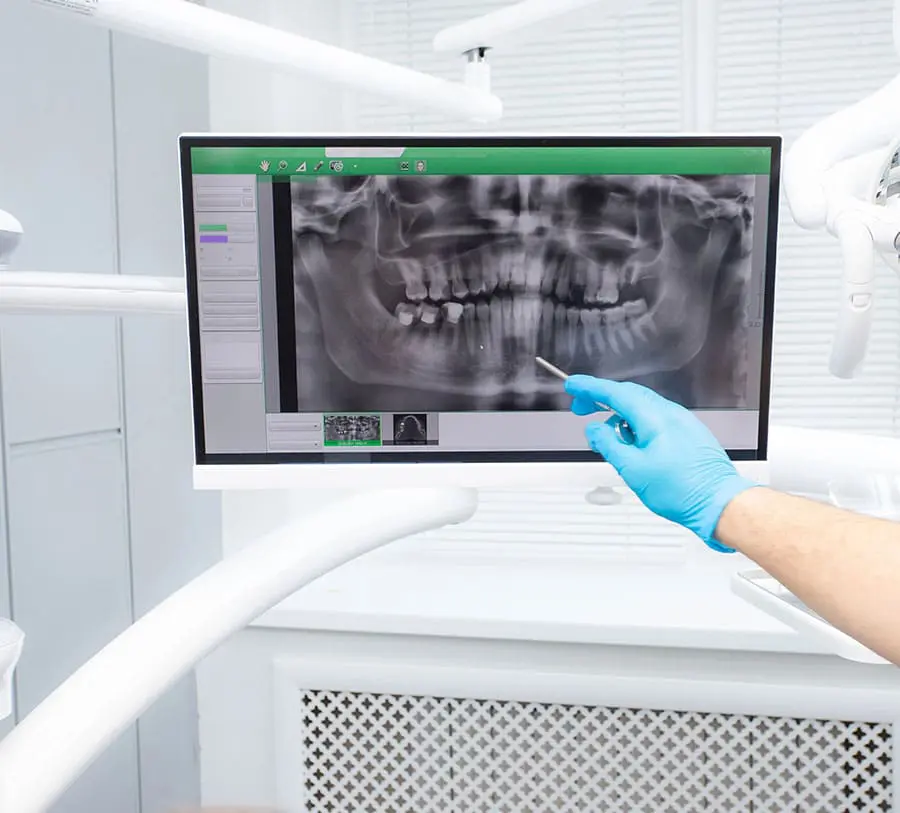 A gloved hand points at a dental X-ray on a computer screen, highlighting the teeth. The setting appears clinical and professional.
