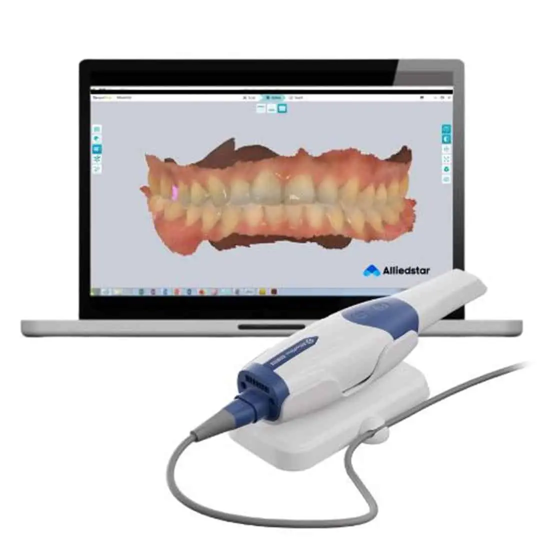 A dental scanner connected to a laptop displays a 3D model of teeth on the screen. The scene is clinical and technology-focused.